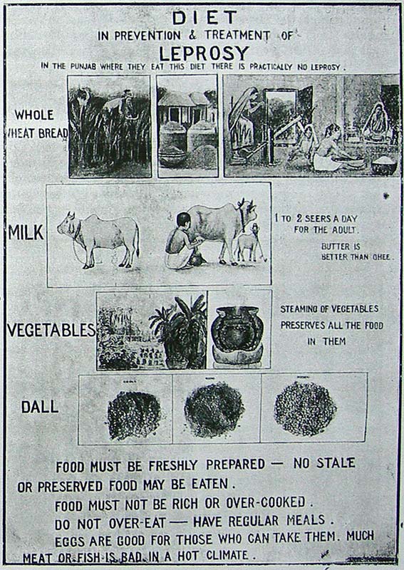 Diet Chart